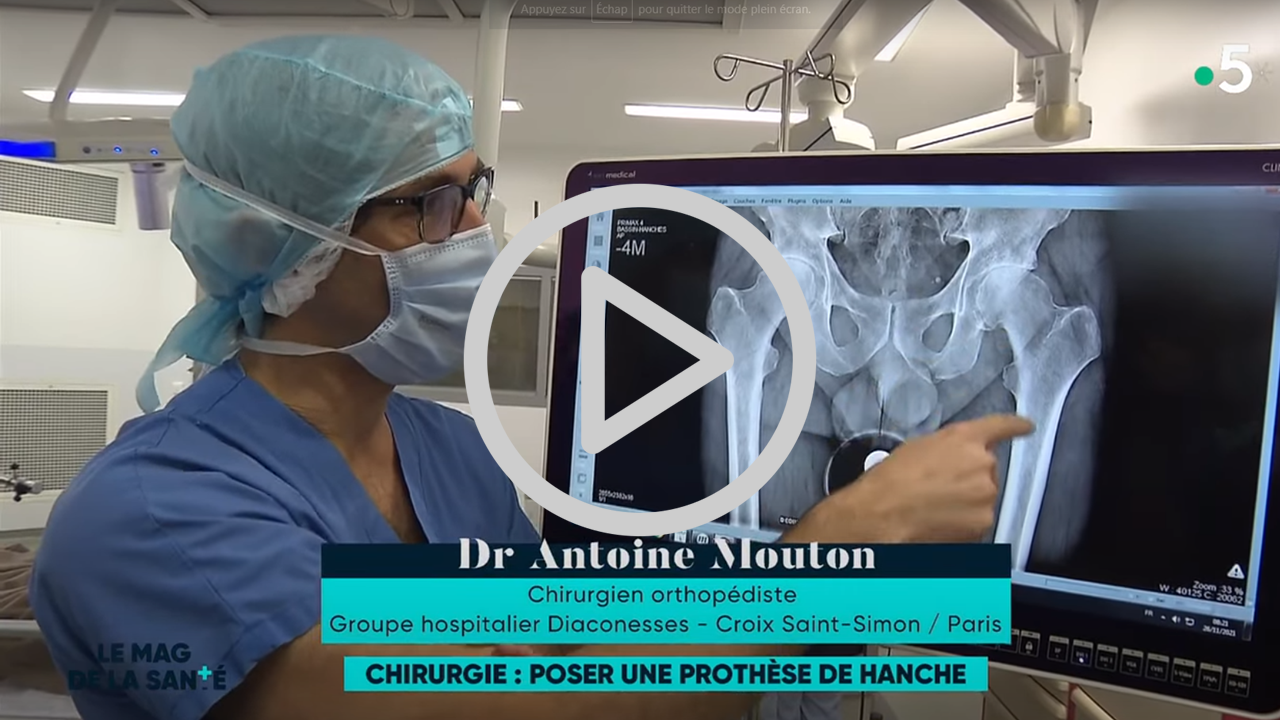 prothèse hanche
