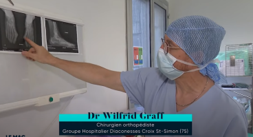 Hallux valgus